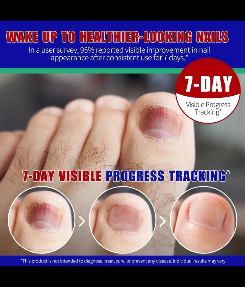 Fungal Nail Repair Patches 21pcs – Overnight Toenail Fungus Treatment Set