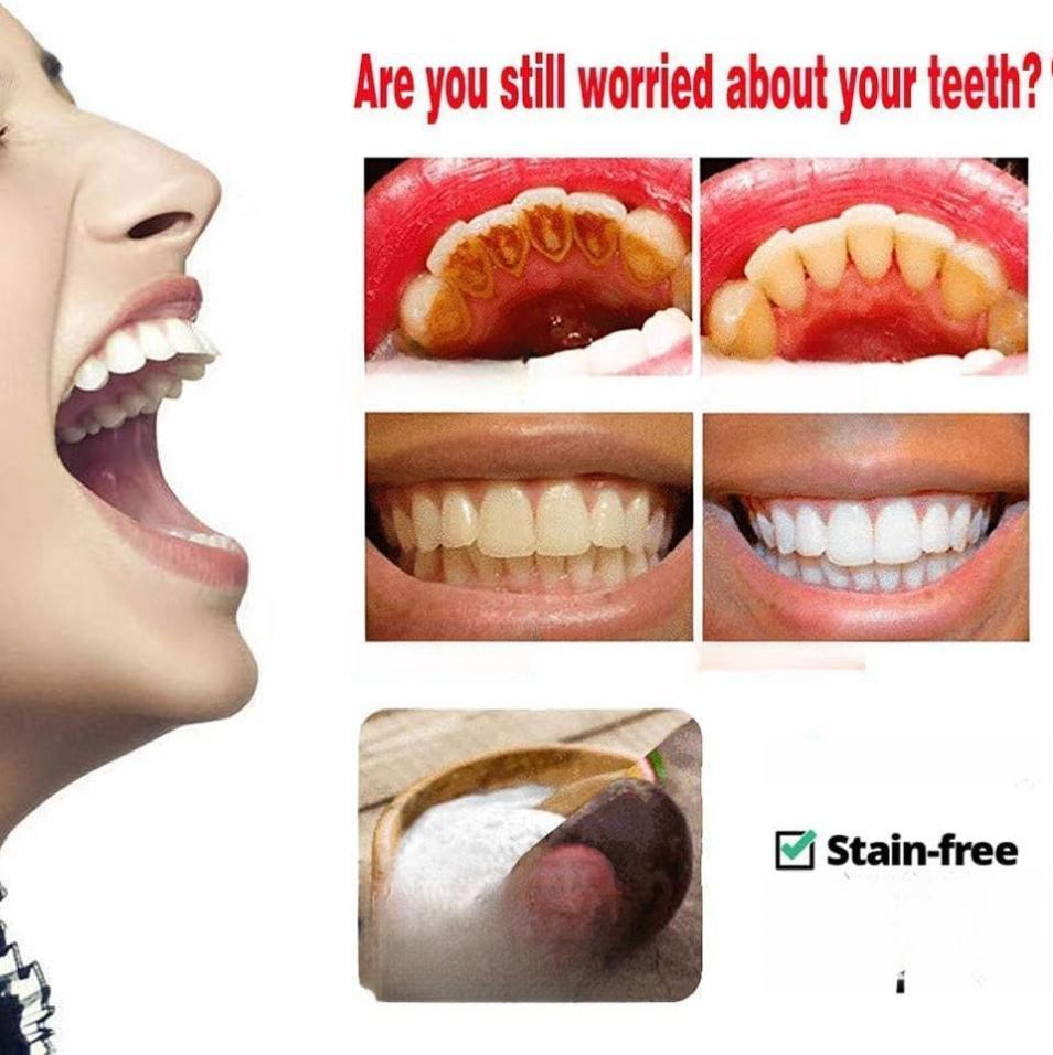Intensive Stain Removal Whitening Toothpaste 2PCS Baking Soda Gel Toothpaste with Passion Fruit & Blueberry Flavor for Fresh Breath Oral Care Fight Bleeding Gums Power Cleaning - Pack
