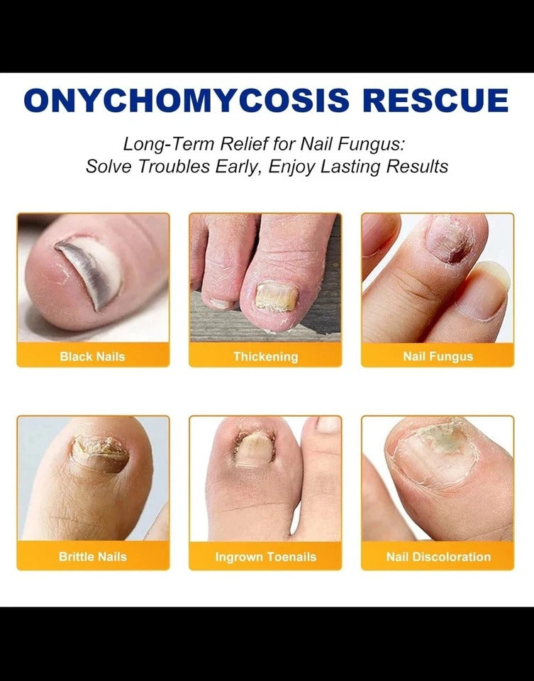 32pcs Toenail Fungus Treatment & Repair Set – Patches + Oil Combo Kit