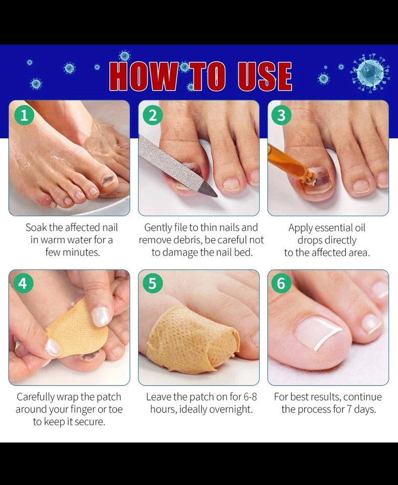 Fungal Nail Repair Patches 21pcs – Overnight Toenail Fungus Treatment Set