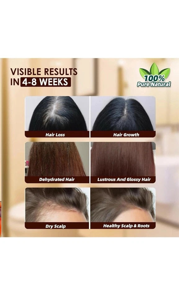 Batana Oil Shampoo And Conditioner Thickening Hair Bundle For Stronger Hair