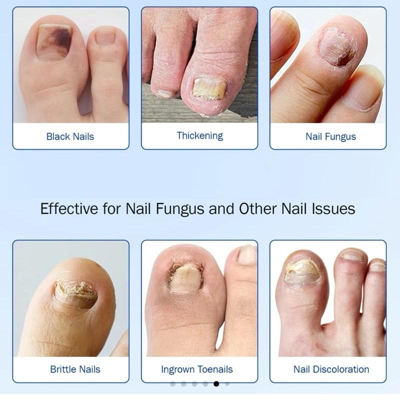 Fungal Nail Patches - 3 Pack 8-Hour Overnight Repair for Damaged & Discolored Nails - 21 Patches for Healthier Nails - Easy Application & Hygienic Design