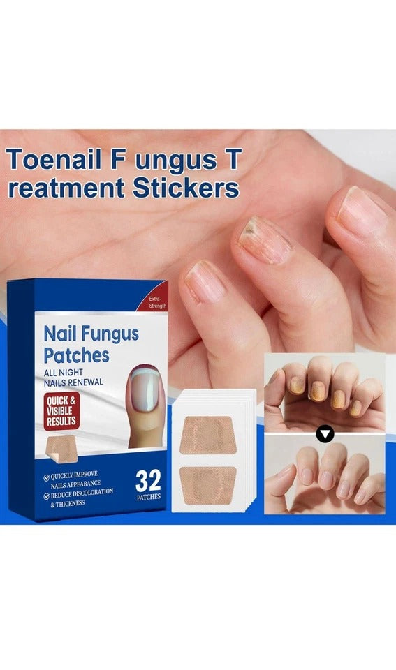 32 Pcs Toenail Fungus Treatment Stickers Toe Fungus Onychomycosis Repair Sticker